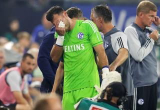 Schalke-Schock: Monatelange Pause für die Nummer eins